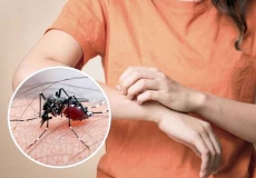 Bị sốt xuất huyết phải truyền dịch? Không phải trường hợp nào cũng cần