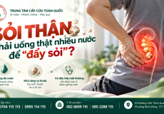 Sỏi thận phải uống thật nhiều nước để đẩy sỏi không?